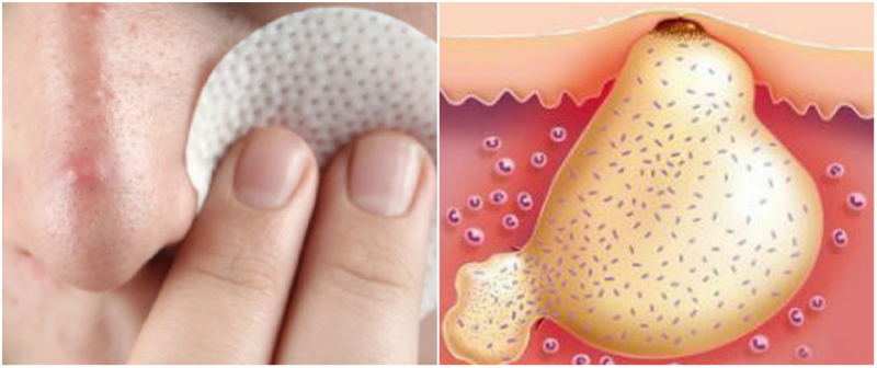 ÐовâÑзане зобÑаженнÑ