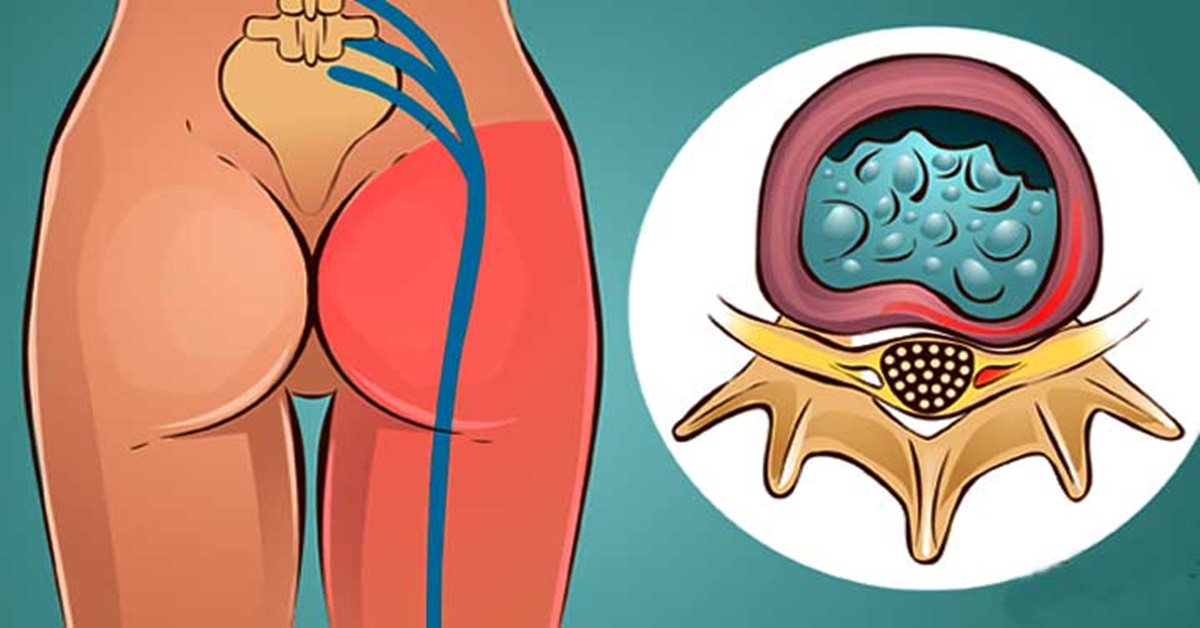 ÐовâÑзане зобÑаженнÑ