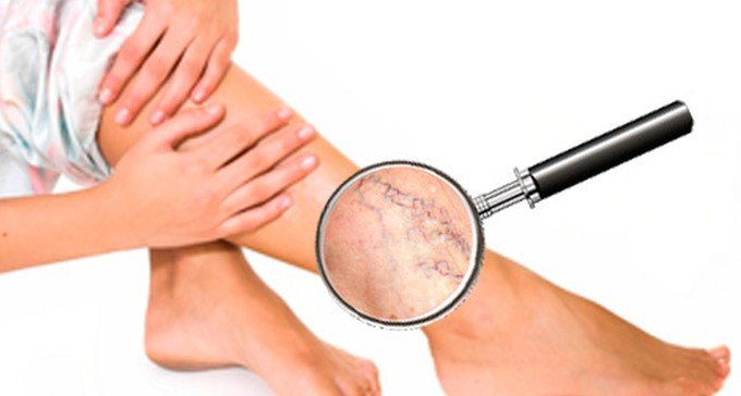 ÐовâÑзане зобÑаженнÑ