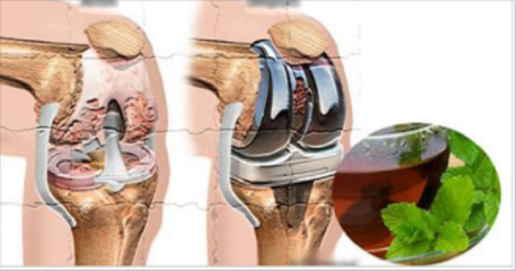 Восстановление сустава без операции. Гемартроз тазобедренного сустава. Гемартроз сустава колена.